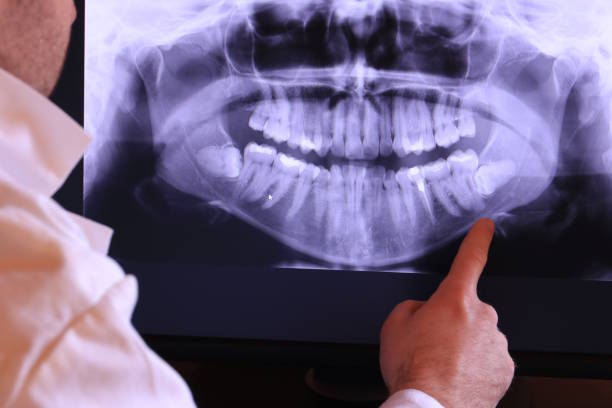 Best Same-Day Emergency Dentist in Sprague, WV