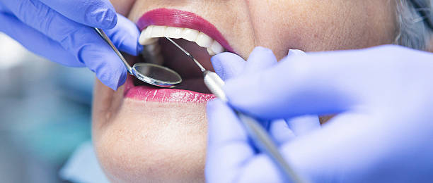 Best Emergency Tooth Extraction in Sprague, WV